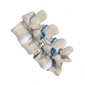 Pedicle Screws Kits II